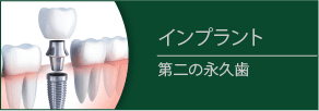 インプラント 第二の永久歯